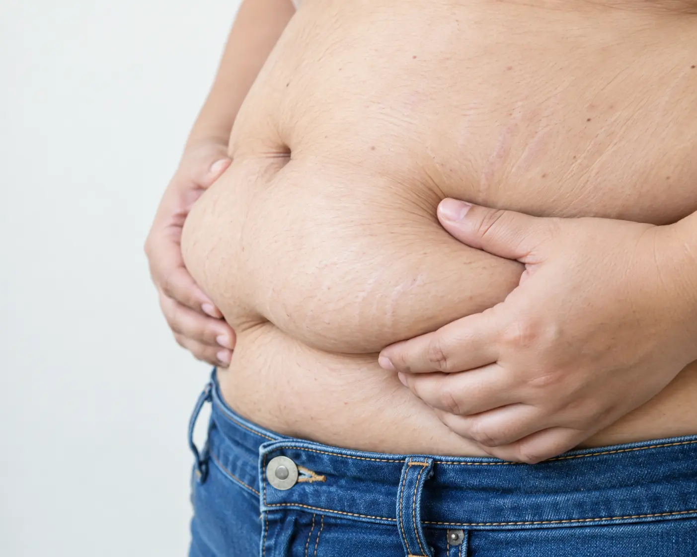 Artikel Skinvest mengenai Weight Management