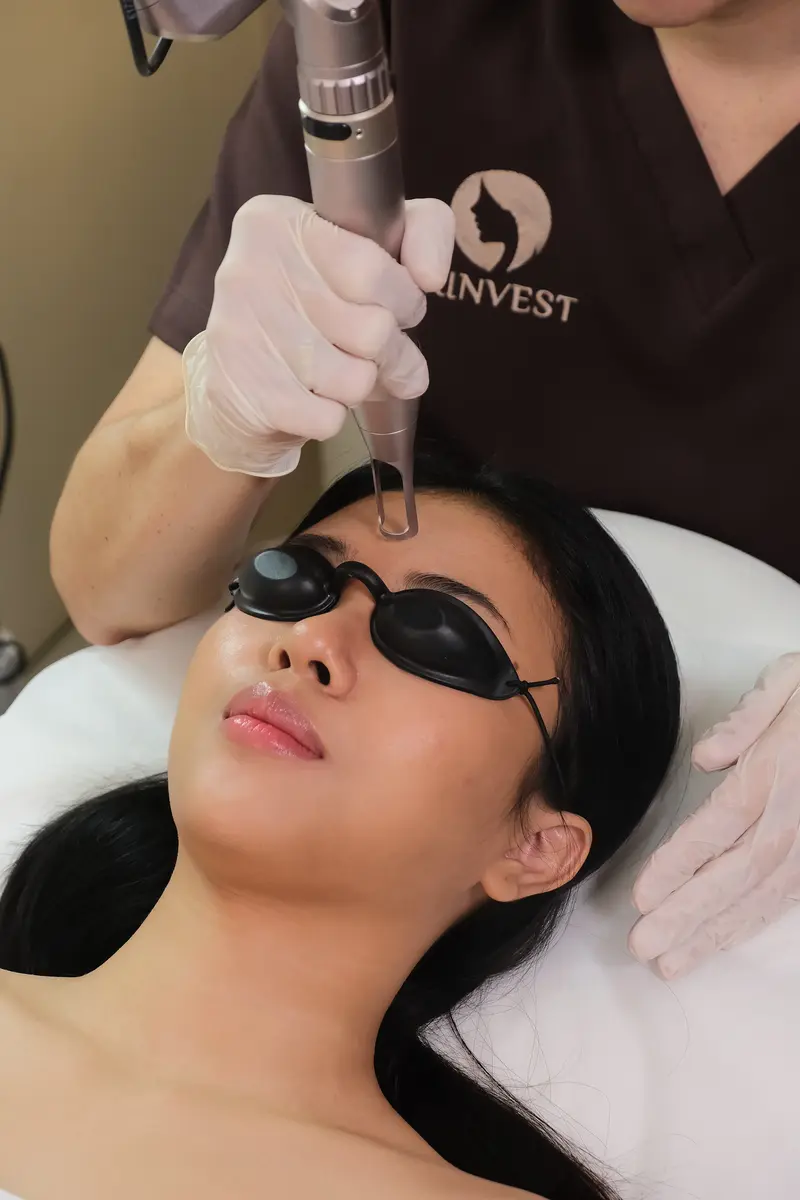 Treatment Laser di Skinvest