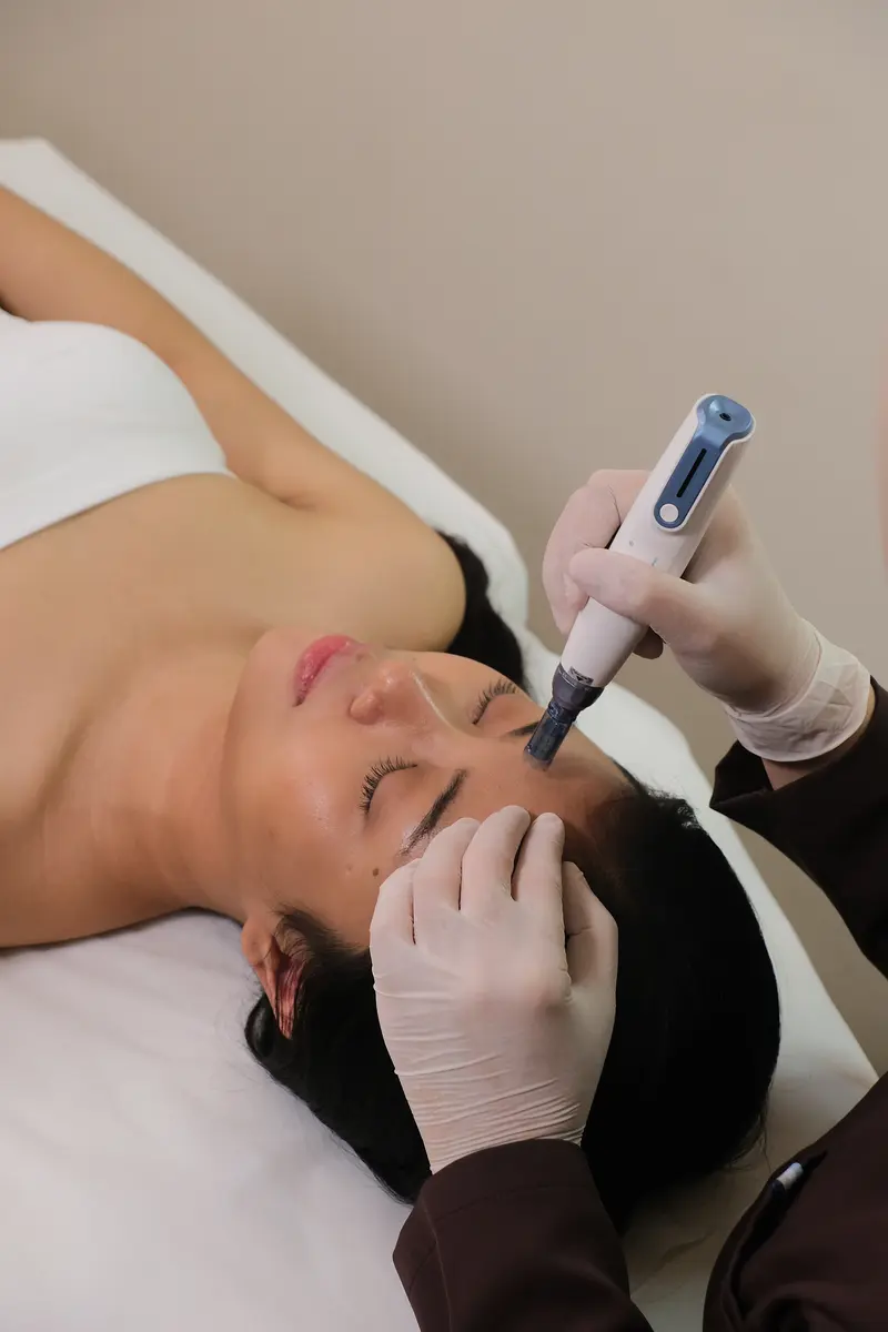 Treatment Mesotherapy & Scar di Skinvest
