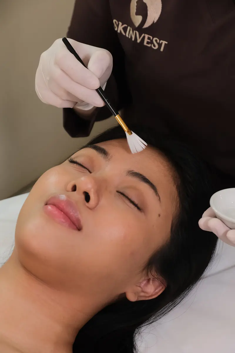 Treatment Peeling di Skinvest